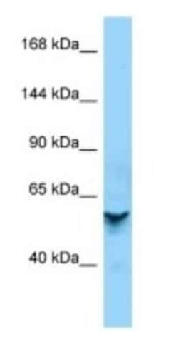 ZNF840P Rabbit anti-Human, Polyclonal, Novus Biologicals 100 &mu;g | Buy Online | Novus Biologicals | Fisher Scientific
